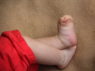 Kleinkinder - Hände und Füsse